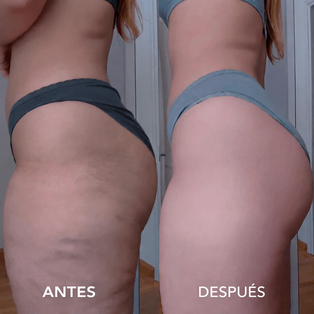 Oil Anti Cellulite